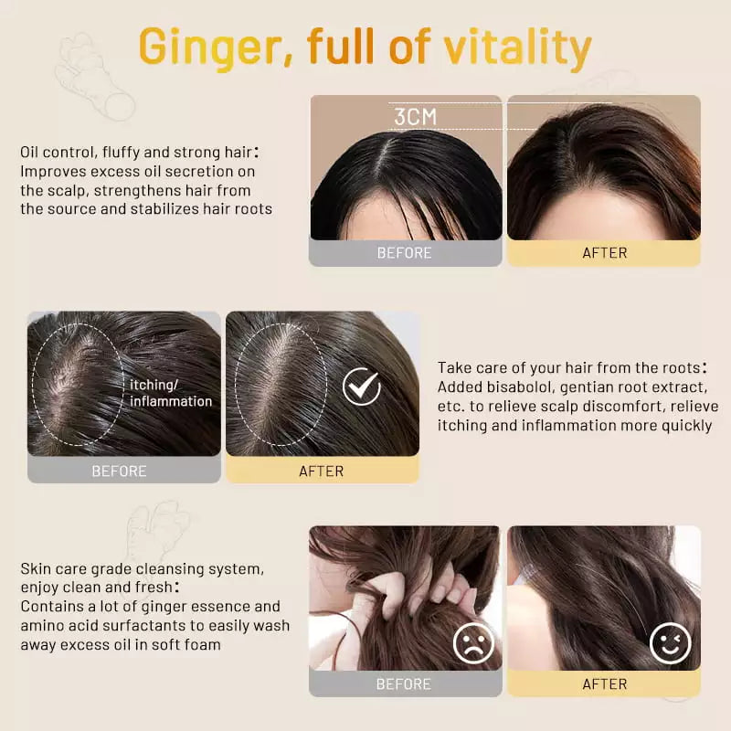 Shampoo Anticaída Ginger