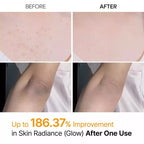 Exfoliante Corporal  Spray
