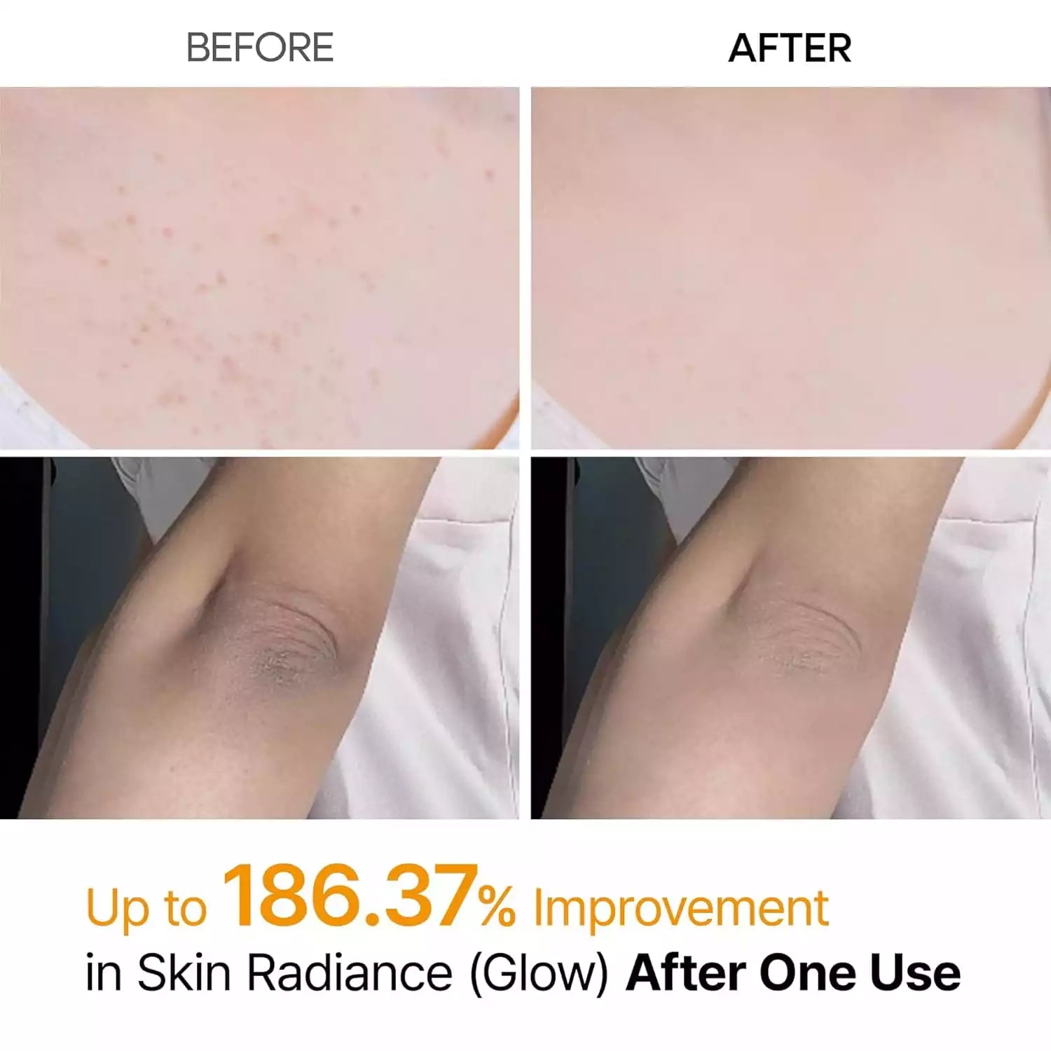 Exfoliante Corporal  Spray