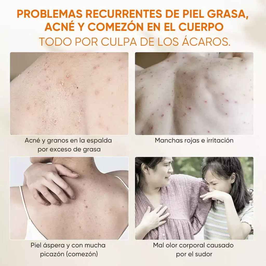 Gel De Ducha Antiácaros
